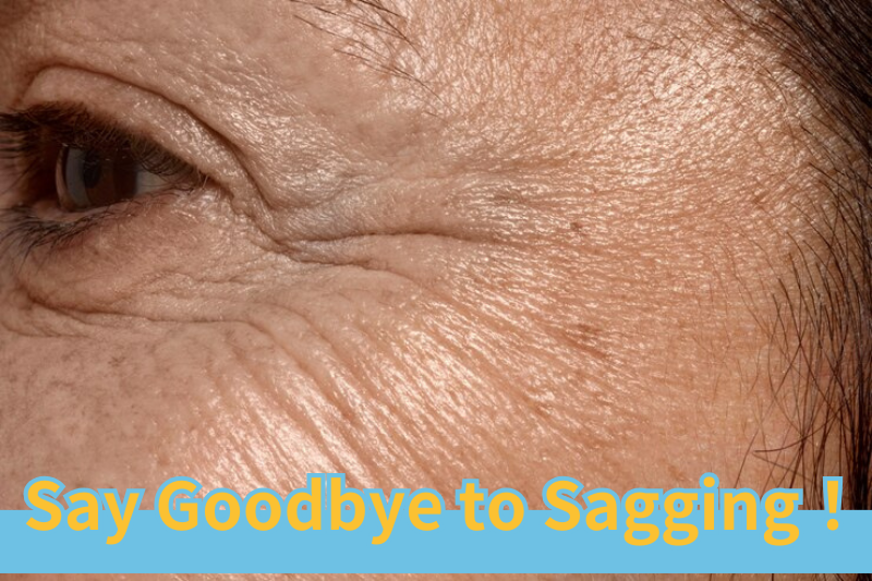 Read more about the article Say Goodbye to Skin Sagging!