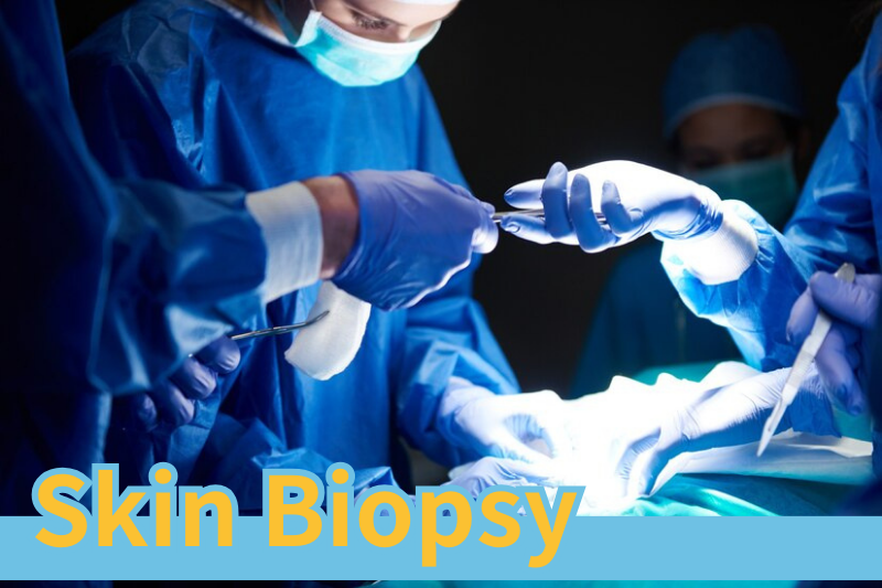 Read more about the article How Skin Biopsies Uncover the Truth About Skin Diseases