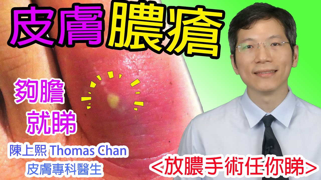 皮膚膿瘡 皮膚膿瘡怎樣治療? 放膿好重口味?