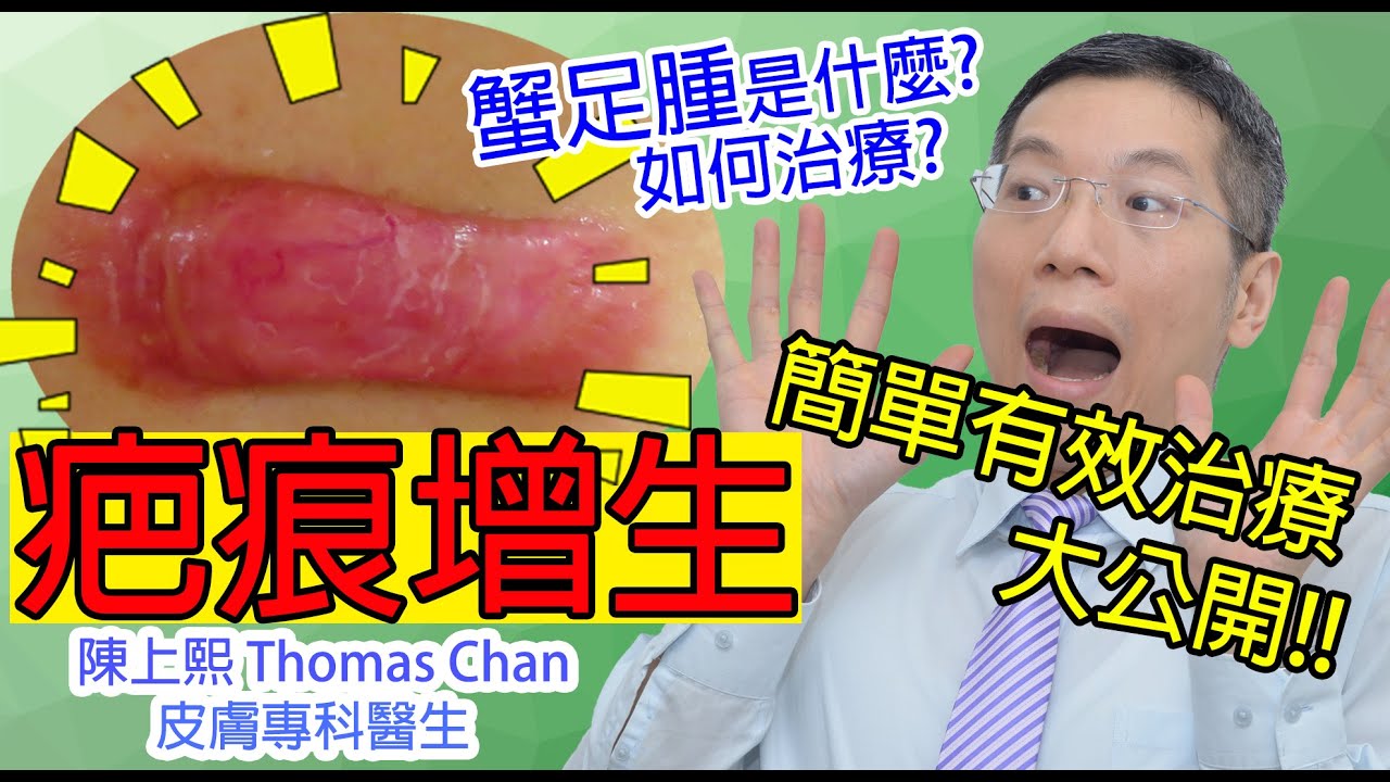 增生疤痕有治療方法?  蟹足腫又是什麼呢?