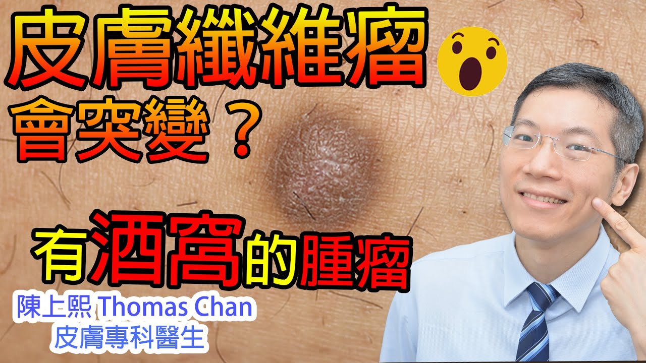 如何治療皮膚纖維瘤？會對身體造成影響？