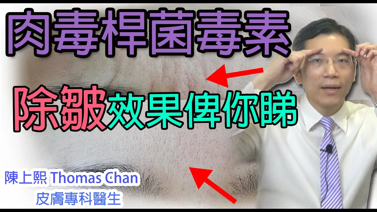 肉毒桿菌毒素去皺效果對比